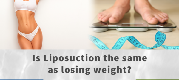 is liposuction the same as losing weight