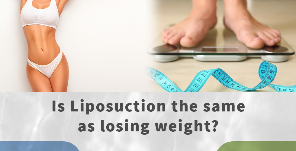 is liposuction the same as losing weight