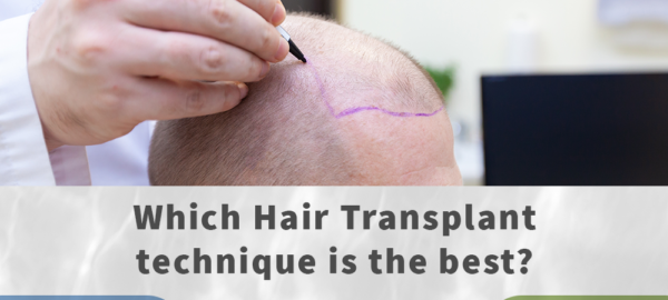 which hair transplant technique is the best?